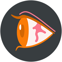 eyes-Irritation